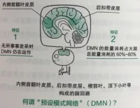 最近狂轟濫炸的所謂精神內耗，其實就是我們腦子里這個實實在在的玩意兒。配圖