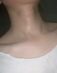 發燒中……配圖