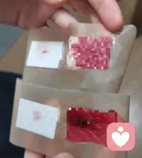 選高中好焦慮啊，我是一個初三的學生，從小學六年級家長工作原因去了日本上學之后感覺身邊沒有了從前的朋友們心里感覺缺了點什么，雖然在日本也有朋友但都不是那種能把真心向他們訴說的人，我爸他脾氣很爆，從小學開始就要求的很多，之前家里買了戒尺小時候默寫錯一個字就要挨揍，當時身上都是青一塊紫一塊的，當時還小，不敢說，但是當時外婆在身邊還能保護我，后來自從去了日本初一的時候自己也非常想努力，我也證明給他們看了，學習都是名列前茅，英語成績更是碾壓他們日本人，但從初二開始我不知道是我爸工作壓力大還是什么，就經常找事和我吵架，就連我放學回家給他們燒頓飯吃他都要來找茬說這個不好吃那個不滿意的，我當時也是一直在忍，后來有一次吵到半夜他直接就上來揍我，還說要殺我，我就報了警，當天晚上我和我媽在外面住的，晚上我奶奶直接視頻通話過來給我劈頭蓋臉一頓罵，說我為什么要報警把我爸打人的事說出去，說那樣他面子怎么掛，我真的很難受，我奶奶居然會那么想，從那之后我們家基本天天都要吵架，他經常打傷我，下面是當時的圖片，手臂上直接被玻璃劃了個口子，當時就血染紅了四個創口貼，后來實在止不住血就去了醫院，但他后來沒有和我道過歉，也覺得他自己生氣拿東西砸人是理所當然，初二一整年基本都是在爭吵中度過的，這些事導致我開始不去學校，厭煩學習，厭煩生活，厭煩一切，當時是有輕生的念頭，但我舍不得我別的親人和朋友，我也不想因為他一個人去了結自己的生命，但是我在日本，身邊沒有一個親人可以幫到我，那段陣子就算快撐不下去了也只能一個人扛著，其實我也想變好，變得和初一的我一樣，但是因為之前的種種原因我學不進去，也沒有心情學，自己承受的壓力太大了，不知道哪天他又會來打我或者拿刀…我也不知道我接下來要怎么跟上學校的進度，腦子真的很亂，當時我參加的社團里有個非常惡心的女生，因為我初一的時候努力為自己爭取到了和先輩一起出場比賽的名額，而且拿到了第一，她就因為她沒有拿到名額而開始嫉妒，處處和我作對，打球故意往我身上打，瞪我，在我因為家里種種原因不能去參加練習的時候處處挖苦我，社團最后的一次聚餐也在找理由讓我不去，陰陽我，我也是不想和她計較，那些都沒怎么在意，但各種事情加起來讓我過得真的很不順心。初三開始我也在嘗試著改變自己，但因為之前落下太多了，我也吃了不少苦，但成績還是回不到從前，他就抓著我的成績不放，怎么做他都要來吵架，我一邊頂著家里的壓力，配圖