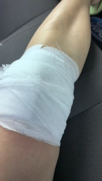 腿上再深的口子也会结痂掉落，心上裂开的缝隙，却怎么堵都漏风，坚持难熬的14天