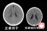 以下是關于父母長期吼叫和打罵孩子的影響:

哈佛醫學院研究認為，父母對孩子長期吼叫的確會改變孩子的大腦，會破壞孩子的大腦，讓孩子大腦發展緩慢，影響他們的智力。 雖然那些大喊大叫的父母本身并沒有毀掉他們孩子的大腦，但他們正在改變孩子的大腦，

下圖是正常大腦和被長期打罵孩子的大腦，可以看到右圖越來越萎縮，孩子越打越笨，因為他的前額葉是大腦的控制中心，負責思考判斷，當孩子遭受打罵時，前額葉會受到刺激，就會出現關閉或正常功能減弱的情況，總是在打罵謾罵中長大的孩子，思考和判斷力就會降低，可想孩子就會變得越來越笨，

而且長時間處于緊張的家庭環境中，孩子也容易緊張焦慮，這時身體就會釋放出這種壓力激素，刺激到海馬體，而海馬體是負責我們記憶力的維持，因此壓力過大會使我們孩子記憶力變差，直接對他們的學習力很有影響，所以非必要的時候我們還要耐著性子跟孩子好好溝通，少點打罵。

到了青春期，孩子也會吼你，吼你，你會哭，你會難過，你會生無可戀。吼他只教會了他一件事兒，就是吼人，吼你，吼同學 ，吼老師，吼同事，吼領導，吼伴侶，吼壞自己身邊所有的關系。

我們教一個人，不僅要規范他的行為，更要先保護他的大腦。只有他的腦子好了，他才能控制好自己的行為。

父母在孩子青春期之前不尊重他們，在青春期之后就不被尊重，家庭當中構建的應該是相互尊重 相互愛 你溫柔的對他，就會教會他有溫柔，有耐心，不自以為是。你為什么吼他？不正是因為你認為自己都是對的嗎？你真的都是對的嗎？這就是自以為是。跟孩子不能商量嗎？不能有點變通性嗎？不能讓他們為自己做主嘛？

我們能為孩子做的事，就是成長好自己，為自己的情緒負 100%的責任，以更好的生命狀態陪伴和引導！因為善待好孩子，就是善待好自己的后半生，就是善待孩子的人生。配圖