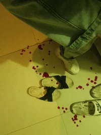 腳底板受傷筋斷了，，縫針了，如何走路如何上廁所，如何洗澡？配圖