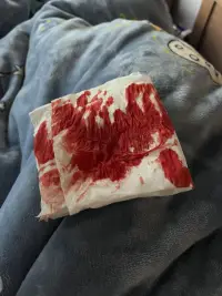 你生活在光亮里，你就覺得全世界都是光亮的，你當然不懂我，你們只會說一切都會好的，調(diào)理自己的情緒，不要去控制它，真的很可笑啊，你們就覺得這么簡單，你體會不到我的感受，就永遠都不會知道我有多痛苦，每天心慌，坐立不安，疲勞，煩躁絕望，失眠，厭食厭世，控制不住的手抖，你覺得我笑了就是好了…我想逃離這個世界，如果有下輩子，我都不會再來了…我就沒想過活過初中…配圖