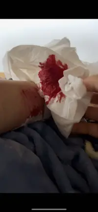 你生活在光亮里，你就覺得全世界都是光亮的，你當然不懂我，你們只會說一切都會好的，調(diào)理自己的情緒，不要去控制它，真的很可笑啊，你們就覺得這么簡單，你體會不到我的感受，就永遠都不會知道我有多痛苦，每天心慌，坐立不安，疲勞，煩躁絕望，失眠，厭食厭世，控制不住的手抖，你覺得我笑了就是好了…我想逃離這個世界，如果有下輩子，我都不會再來了…我就沒想過活過初中…配圖