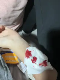 你生活在光亮里，你就覺得全世界都是光亮的，你當然不懂我，你們只會說一切都會好的，調(diào)理自己的情緒，不要去控制它，真的很可笑啊，你們就覺得這么簡單，你體會不到我的感受，就永遠都不會知道我有多痛苦，每天心慌，坐立不安，疲勞，煩躁絕望，失眠，厭食厭世，控制不住的手抖，你覺得我笑了就是好了…我想逃離這個世界，如果有下輩子，我都不會再來了…我就沒想過活過初中…配圖