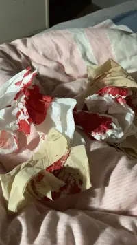 你生活在光亮里，你就覺得全世界都是光亮的，你當然不懂我，你們只會說一切都會好的，調(diào)理自己的情緒，不要去控制它，真的很可笑啊，你們就覺得這么簡單，你體會不到我的感受，就永遠都不會知道我有多痛苦，每天心慌，坐立不安，疲勞，煩躁絕望，失眠，厭食厭世，控制不住的手抖，你覺得我笑了就是好了…我想逃離這個世界，如果有下輩子，我都不會再來了…我就沒想過活過初中…配圖
