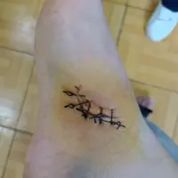 拆線了拆線了拆線了，今天鼓起勇氣看拆線的過程，邊看邊哭，但是還是不能走路。配圖