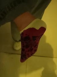 拆線了拆線了拆線了，今天鼓起勇氣看拆線的過程，邊看邊哭，但是還是不能走路。配圖