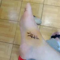 嗯好像好很多了.可以走路了，但是好像還是一瘸一拐，但是呢比單腳跳好多了配圖