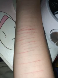 今天剛割手腕配圖