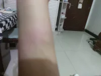 我真的不知道怎么辦了，又被打了連我最信任的姐姐也這樣了配圖