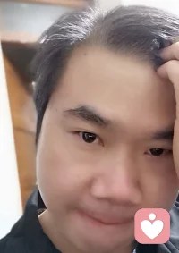 一直都渴望有好看的雙眼皮、濃密的頭發，想給自己咨詢一下，發現受咨詢目標限制！配圖