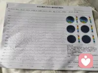 医院成天给我打电话，叫我去复查，但我感觉我状态也挺好的，就一直没去。
这个医院每次给我开好多药，开了好几次，只有保留下来几次服药卡，然后不停的换药，我感觉是不是他老换药对我病情也有影响。
异常脑电图和地形图是之前大夫说双向情感障碍导致有癫痫波，其他的我没听见配图