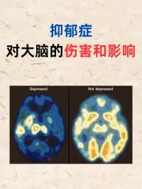 腦科學顯示：每周擁抱超過7次的人，抑郁風險直降43%。（當然不只擁抱人，還有小貓小狗布娃娃毛絨玩具都行）配圖