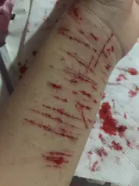 等等  等等在等等配圖