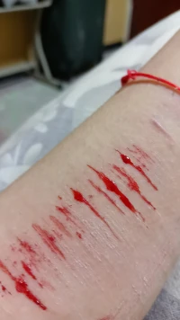 凌晨她拿起了小刀 劃出一道道口子 血順著手滴了滿地 她看著滿是傷痕的左腕 又看了好似正常人的右腕 她愣住了 她好像不知道 哪個才是真正的自己配圖