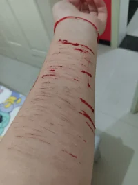 凌晨她拿起了小刀 劃出一道道口子 血順著手滴了滿地 她看著滿是傷痕的左腕 又看了好似正常人的右腕 她愣住了 她好像不知道 哪個才是真正的自己配圖