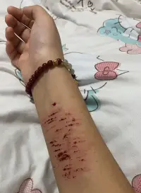 想死……配圖