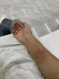 想死……配圖