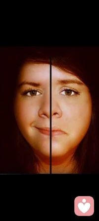 雙相情感障礙，又叫做躁郁癥，是一種常見的精神疾病，表現出明顯的躁狂和抑郁發作。此病病因仍不清楚，但研究提示遺傳決定等生物學因素和心理社會因素等可能與其發生有關。對于遺傳因素，調查發現雙相情感障礙的遺傳度高達85%。雙相情感障礙的患病率在全球范圍內約為2.4%，主要發病年齡在成人早期，男女患病率幾乎均等。配圖