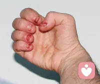 啃指甲好爽配圖