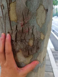 傷疤脫落的瞬間，不是結束，是新生的開始——那些曾讓你痛的，終會讓你更堅韌。配圖