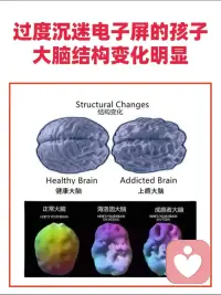 #孩子沉迷游戏，并不是单纯贪恋快乐，更不是道德问题，本质是在逃避现实痛苦。

    现实中的学业压力、家庭矛盾、人际孤独，让游戏成了孩子的避难所。

    然而，短暂的掌控感背后，是不断加重的恶性循环。

    因此，咨询的核心不是强行戒断，而是找到痛苦根源，帮孩子重建情绪调节能力，学会直面现实，自然就无需再躲进手机了。
​
​
​
​配图