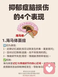抑郁症脑损伤的4个表现配图