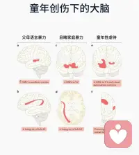 童年创伤是如何损害大脑的？配图