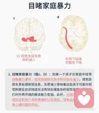 童年创伤是如何损害大脑的？配图