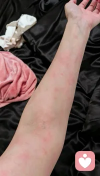 和过敏的第N次重逢，像一场宿命般的约定。
允许脆弱，允许不完美，允许这个偶尔会过敏的自己。