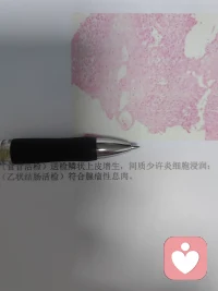 肠道与情绪是因肠脑轴双向影响，肠道合成 90% 的血清素，菌群调控大脑情绪；而焦虑、抑郁、压力……负面情绪又会扰乱肠道蠕动与菌群平衡，引发肠胃不适，二者易形成恶性循环，需兼顾养护与调节。配图