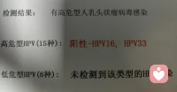 女性朋友，爱上熬夜的你。你可能熬的不仅是夜，最重要的是你造成自己身体的伤害。爱自己，从不熬夜开启🌹