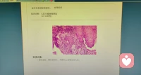 女性朋友，爱上熬夜的你。你可能熬的不仅是夜，最重要的是你造成自己身体的伤害。爱自己，从不熬夜开启🌹