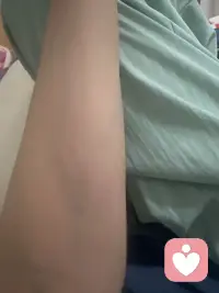 今天走公园像误闯了蚊子王国，二手臂上起码被咬几十下，黝黑的小蚊子，攻击力极强丫！配图